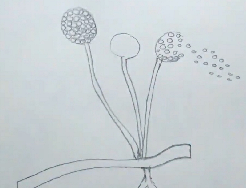 Identification of the fungus AspergillusMucorRhizopus by wet mount  using LPCB  Practical Experiment  Microbiology